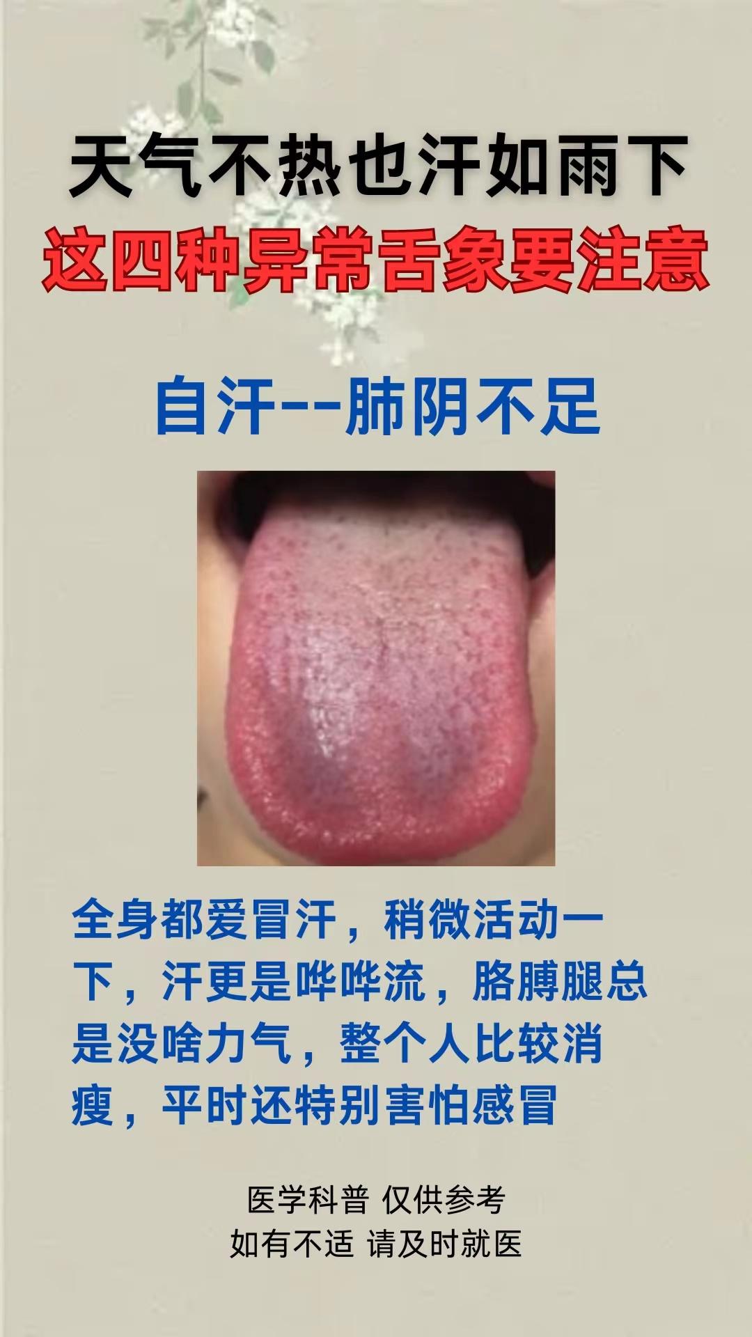 整天大汗淋漓，出汗多，满头汗，这4种异常舌象，一定要注意了[赞][赞][赞]
1