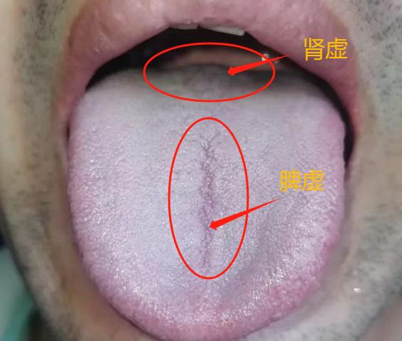 年轻时不懂节制，导致肾被掏空，如今想力挽狂澜，补肾却总不见效果？这是咋回事呢？
