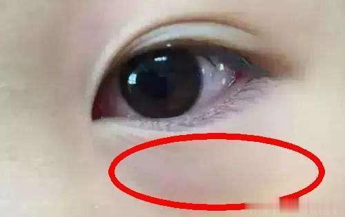 孩子脸上有这5个特征，一眼就能看出孩子脾胃是好是坏！

孩子的脾胃健不健康，面部