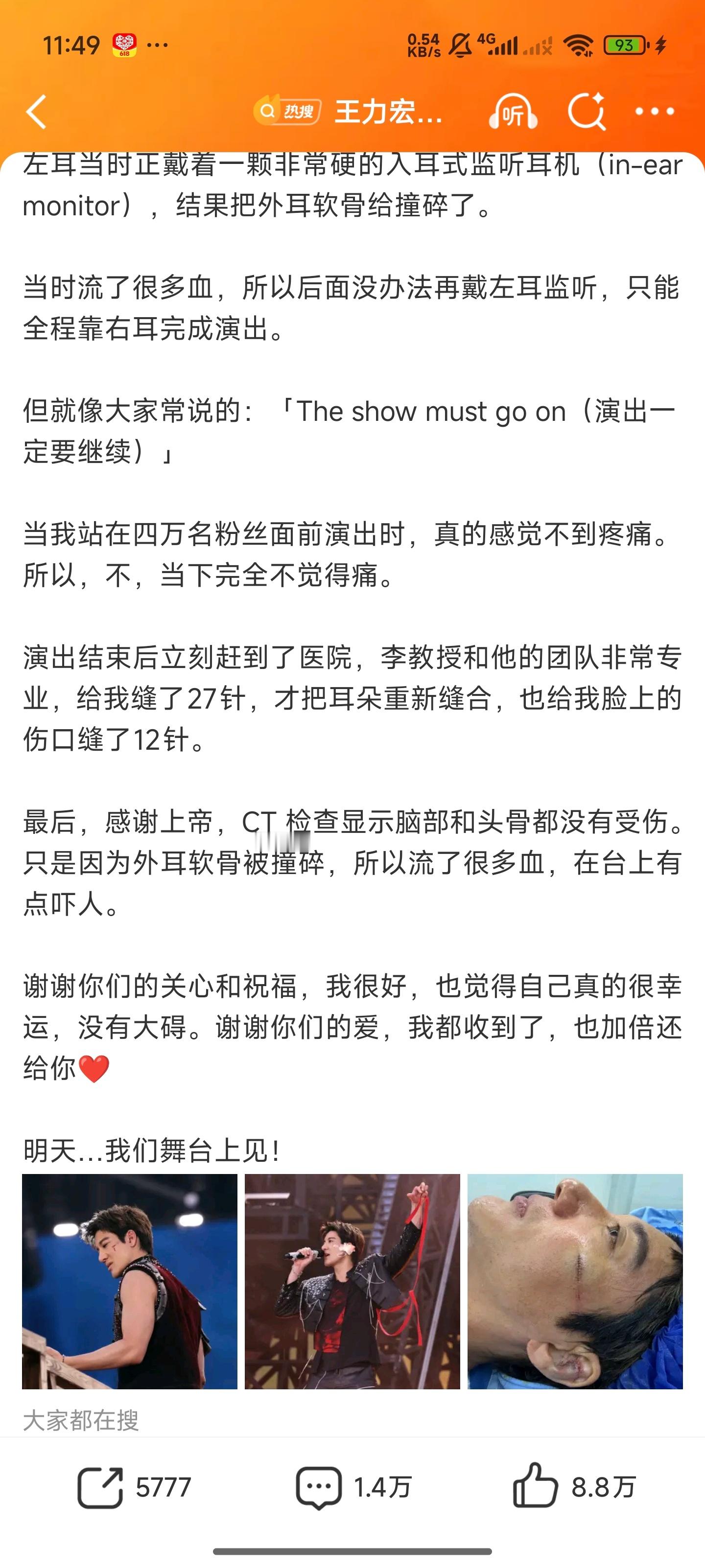 王力宏缝了39针我的天，看着都疼演出舞台的楼梯可不比日常的楼梯那样，很多都没有处