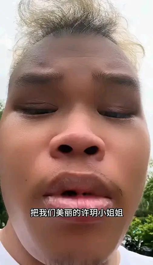 申花记者许玥自称被攻击出血一事还在舆论中！事件还是上海德比后，穆斯卡特在谢场时踩