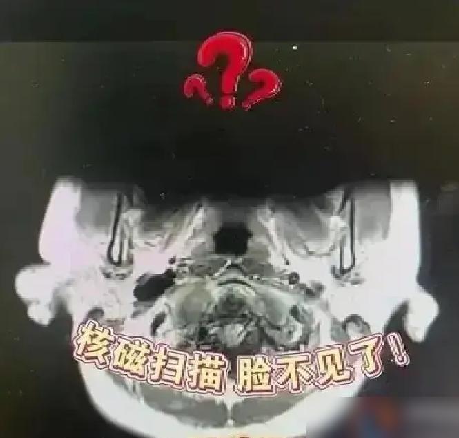 福建29岁姑娘头晕去做磁共振，结果机器嗡嗡响了两回都中途报警停了。

我之前陪家