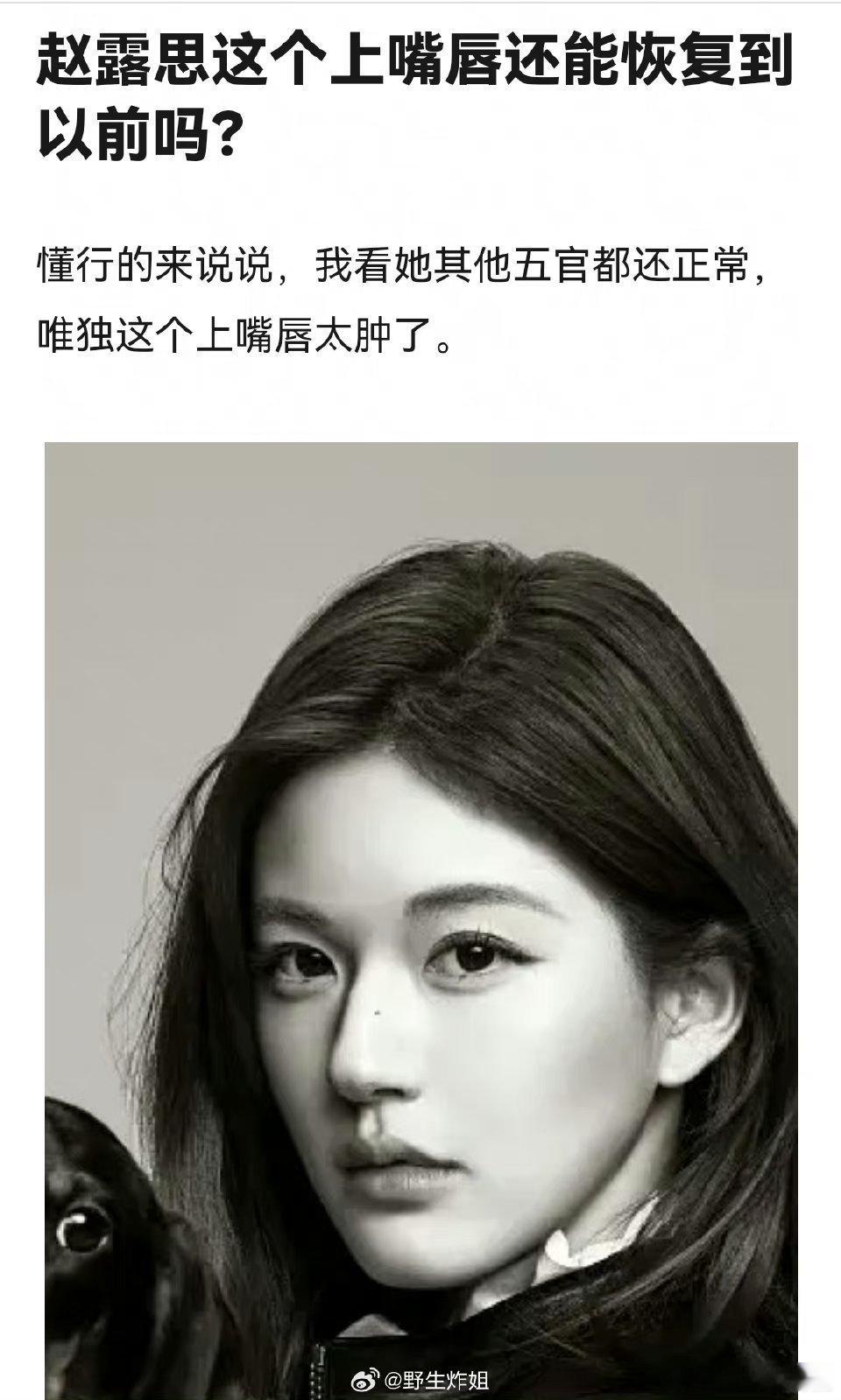 感觉赵露思的上唇故意就是做成那种嘟嘟的状态吧[求关注][求关注]好看不就行了吗？