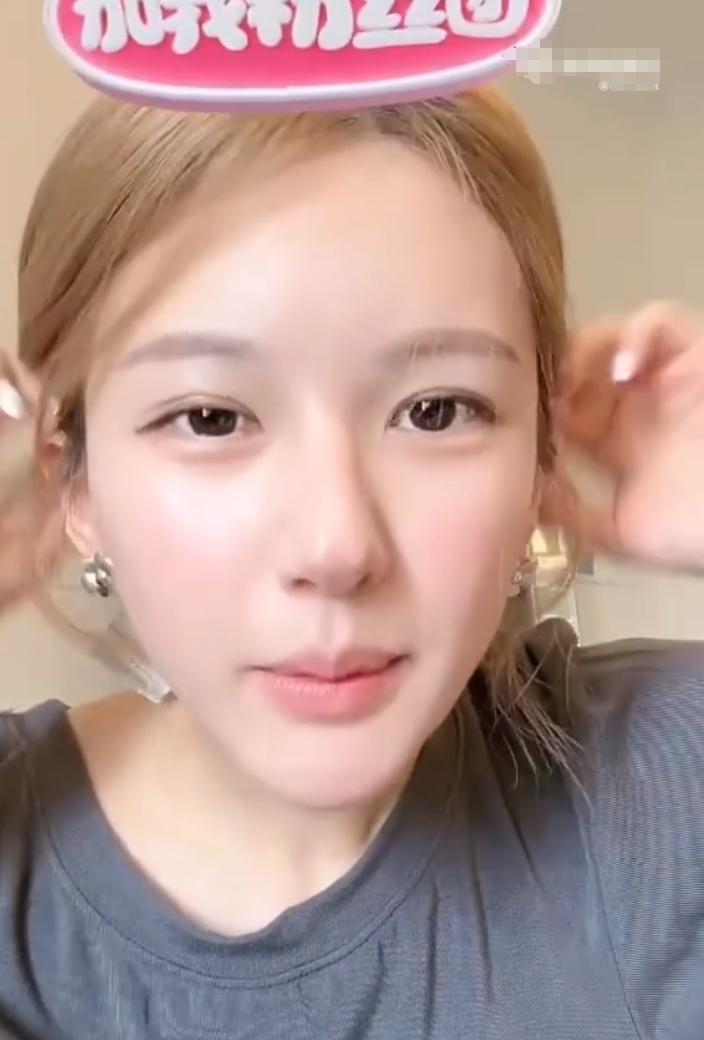 赵露思发文寄居蟹永远没有代表作
很多人觉得她应该是回应热搜“明星抑郁症不挂号挂热