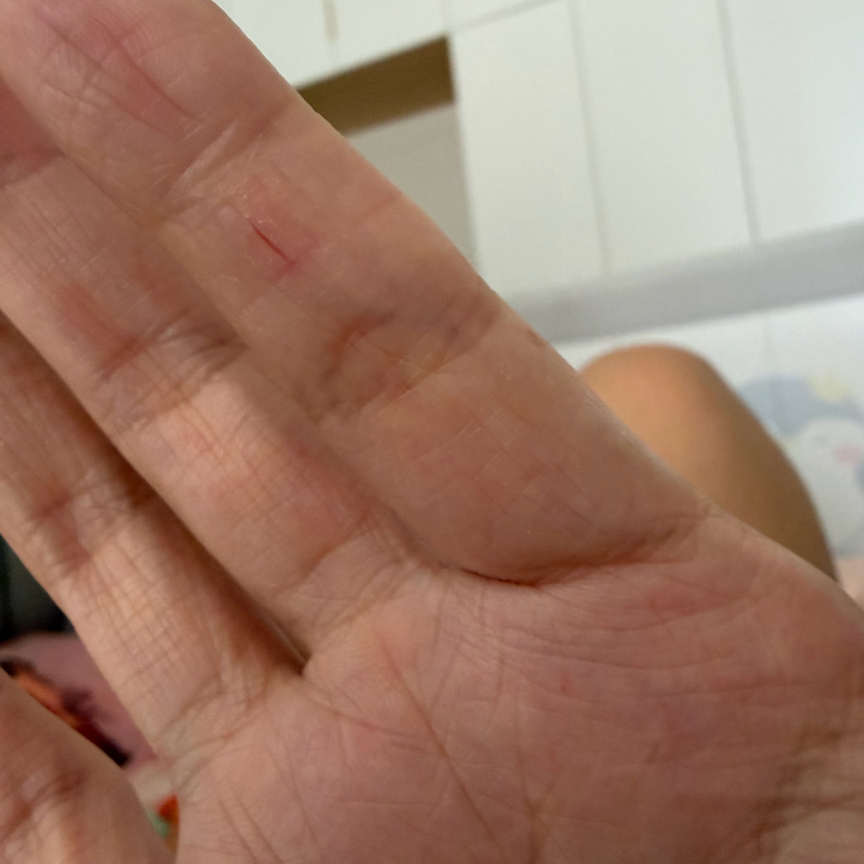 皮肤干裂会公平的惩罚每一个经常摸水但不爱抹护手霜的人[跪了] ​​​