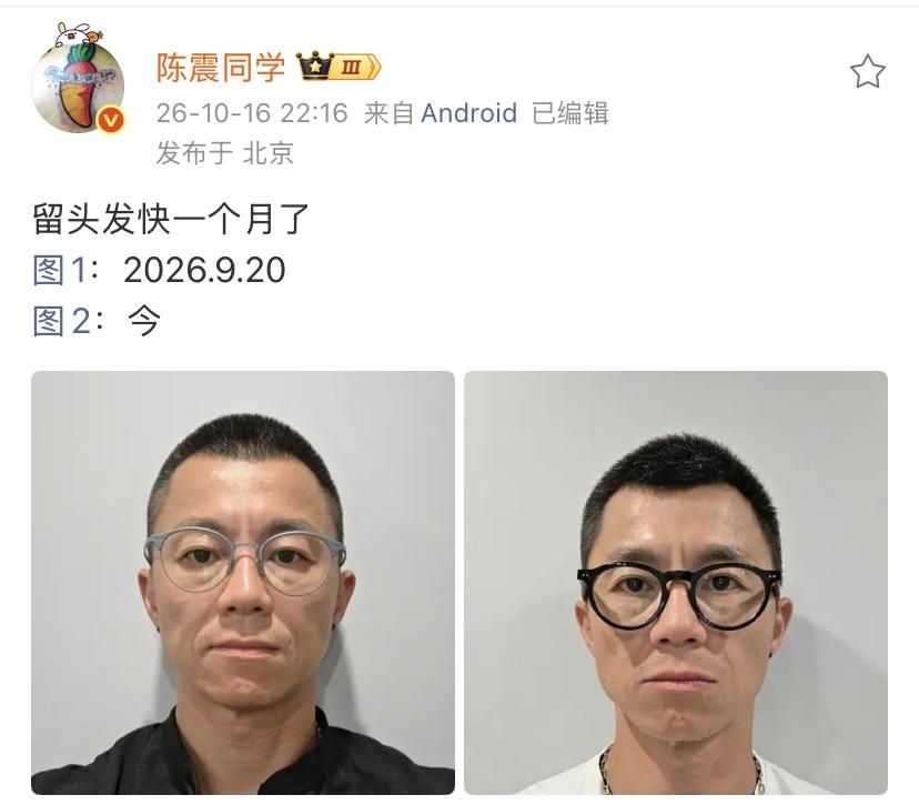 陈震：留头发快一个月了
图1：2026.9.20
图2：今  

这一个月的头发