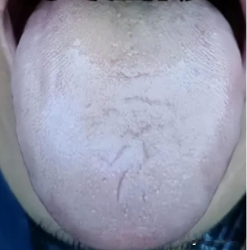 同样是泄精，用手比同房危害大得多！！！

患者主诉：年轻的时候不注意节制，经常自