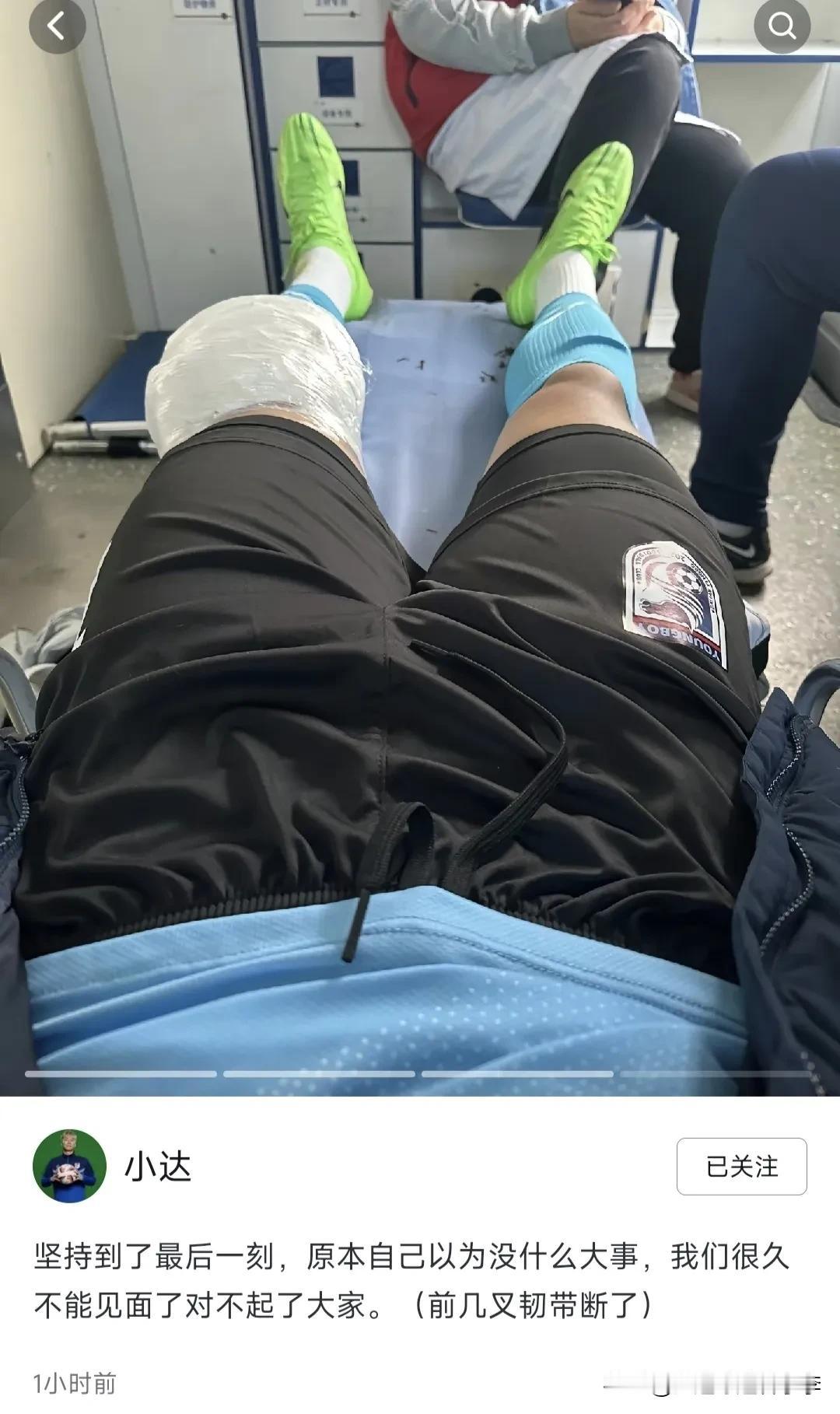 在大连英博3:2逆转辽宁铁人的比赛中受伤的王腾达，确定为前几叉韧带断裂。
好好养