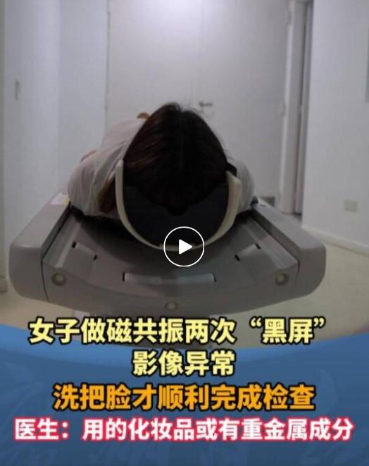 泉州 29 岁姑娘小雅这事儿也太离奇了！因为头晕去医院做头颅磁共振，结果连续两次