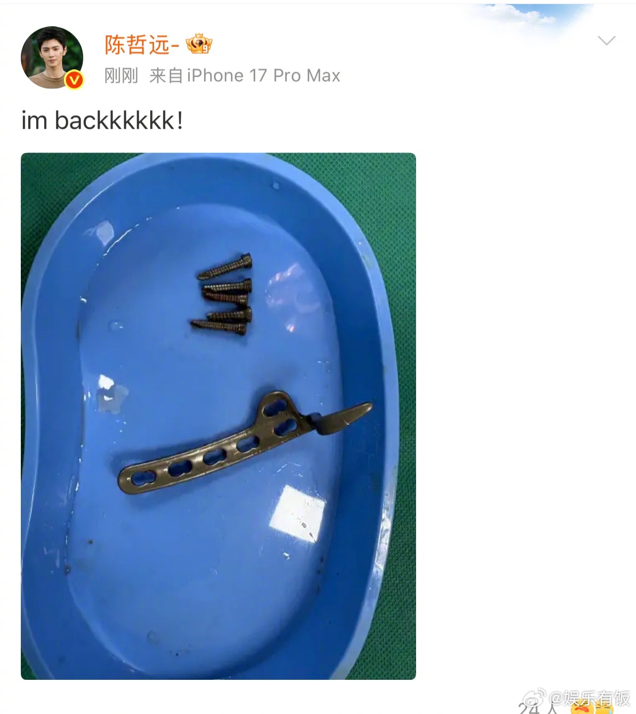 陈哲远做完手术报平安陈哲远做完手术取出5颗钉子 呜呜呜哲远做完手术就跟大家报平安