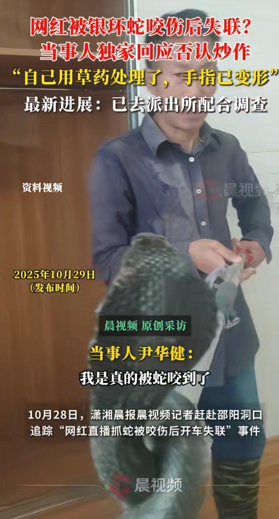 被蛇咬后失联网红称手已变形银环蛇没注毒？他是神经毒素不是肌肉毒素，一般会引起肌无