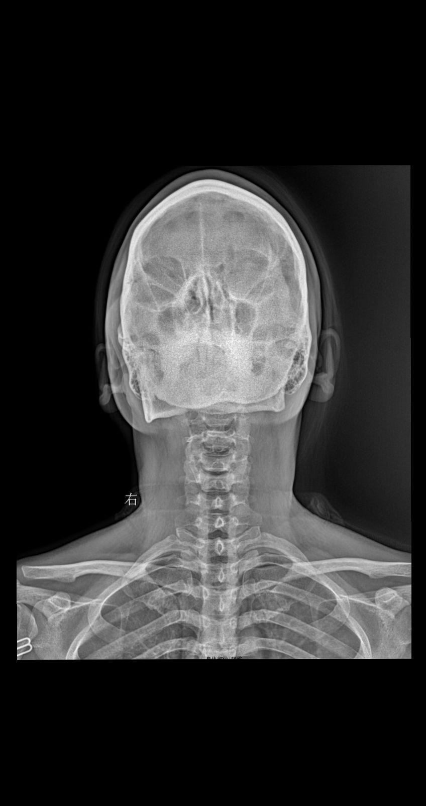 颈部疼痛 头晕 就诊