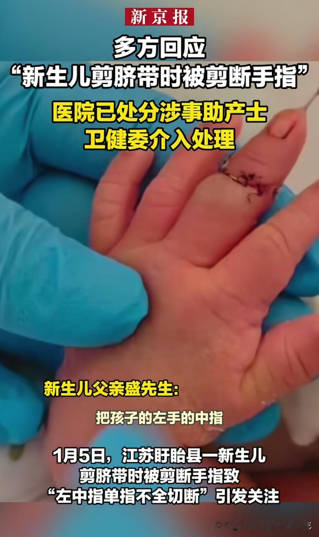 我的天哪，让孩子一出生就变残疾，算得上重大医疗事故了吧！最近，江苏盱眙一助产士剪