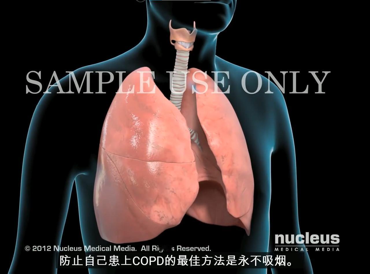 95% 的慢阻肺患者，记好这个方法就够了！
这可能是我最后一次分享这条内容了！之