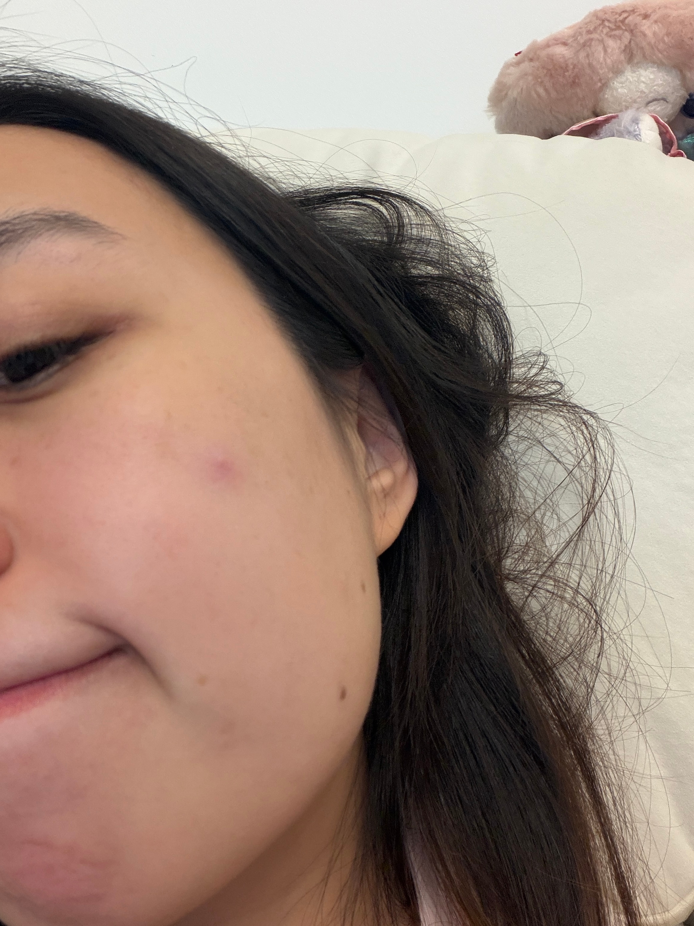 游泳真的要好好护肤我找的泳池已经算是很不错的了游了三天脸上从不长痘的位置冒出一颗