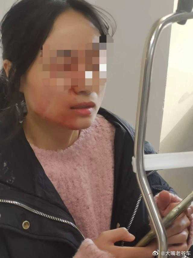 戳伤女教师学生不满14岁不予处罚 这样的“不处罚”，以后哪个小学老师还敢管学生？