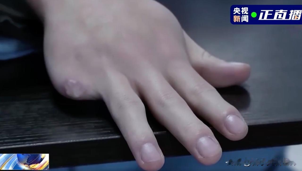 缅北电诈园区剁人手指泡酒……

最近三天央视连着放缅北集团覆灭的节目，看着还是挺