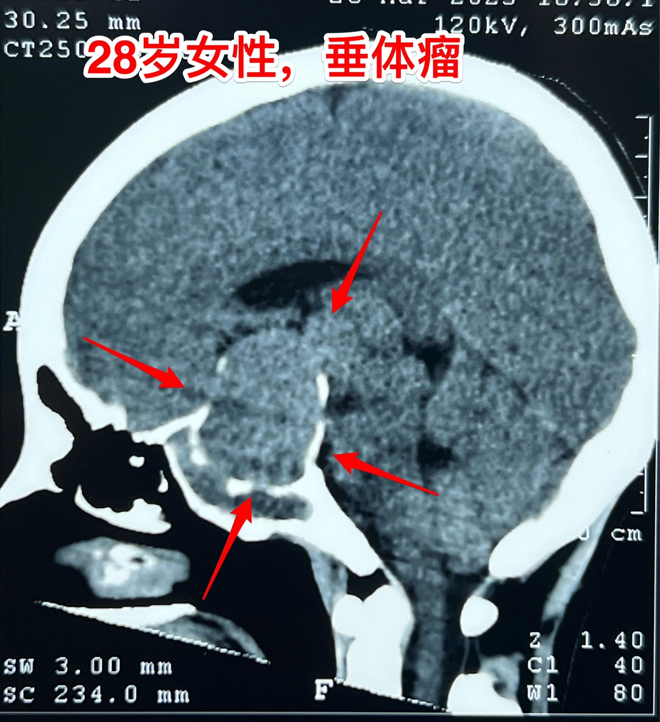 28岁女性6年前生完孩子就一直内分泌紊乱。山西省晋城市28岁女性，6年...