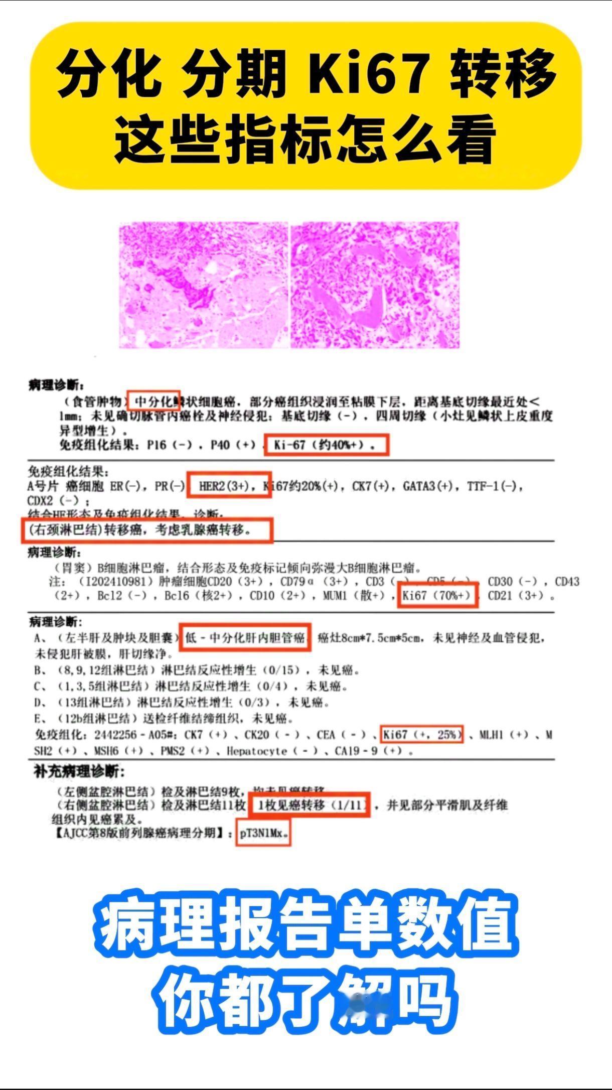 留下您的报告单，我帮您看