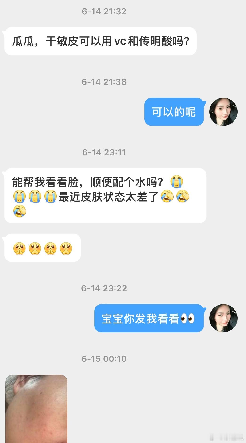 刚刚又双向奔赴了这么明显的改变改善，让人有种踏踏实实的幸福感谢谢大家的反馈你们满