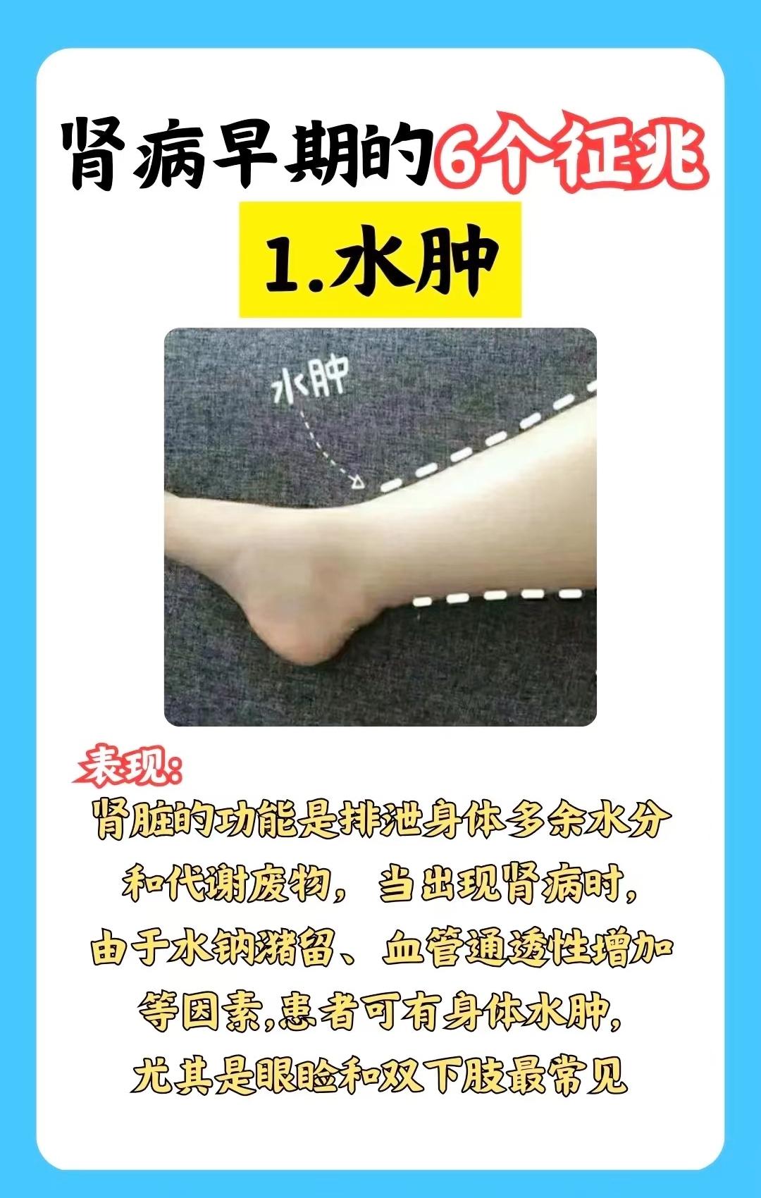 肾病早期的六个明显表现