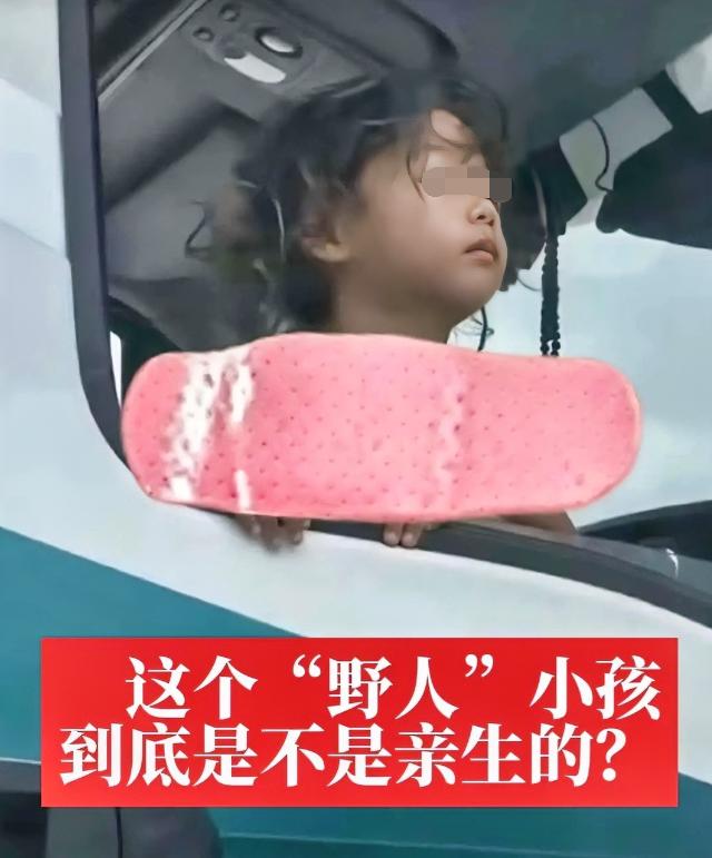 小孩很帅
眼神充满坚毅
目前看脊椎可能已经弯曲了，不过只要能够及时接受救助

相