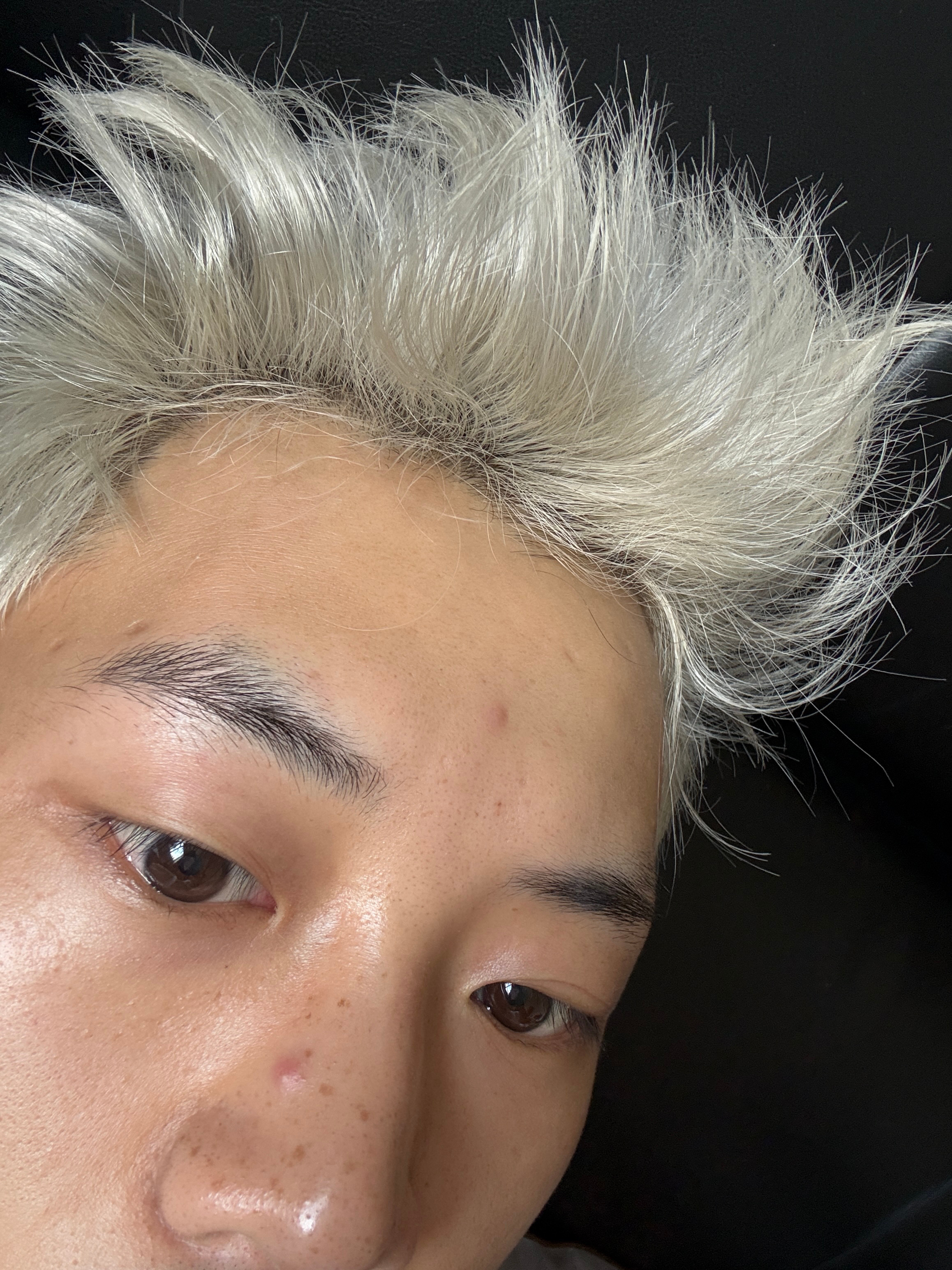 莫匹罗星软膏真的有用，鼻子上的火疖子小了点，额头上的刚长没啥变化。 