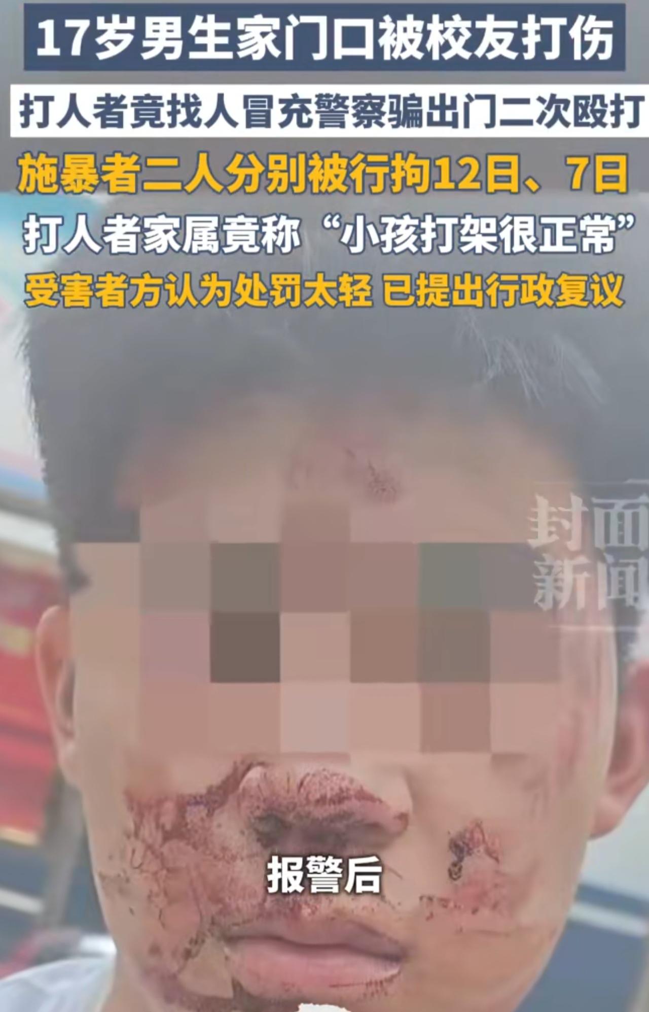 山西运城，一17岁高中生被两个男子殴打后，对方仅仅拘留了12天和7天。网友:犯罪
