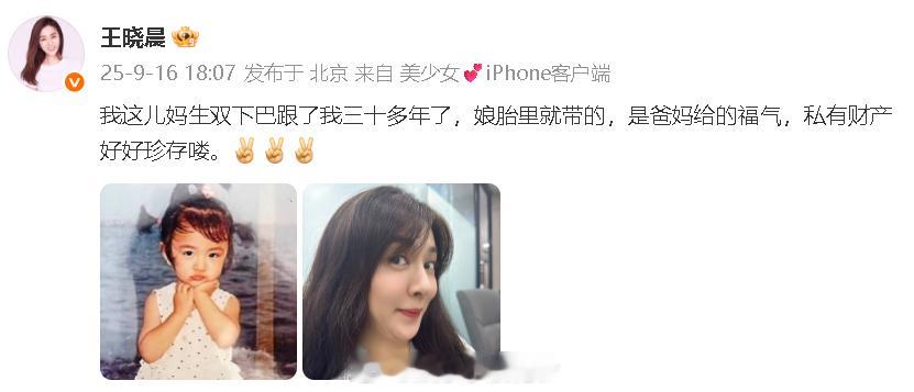 王晓晨回应双下巴 “我这儿妈生双下巴跟了我三十多年了，娘胎里就带的，是爸妈给的福