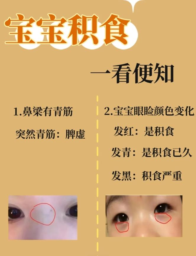 孩子积食不长个，6个症状一看便知，4碗汤加4个按摩法，消积只需半个月

积食，顾