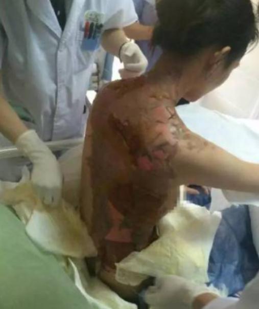 "这就是嘴欠的下场"！2015 年浙江一女子在火锅店要求加汤，因店里客人繁忙，服