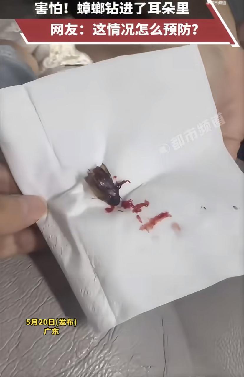 太吓人!耳朵里又痒又疼，一查竟钻进一只活蟑螂!
广东一女子总觉得耳朵里有东西在爬