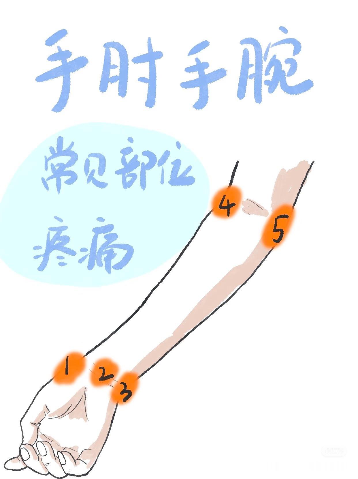 运动康复 【手腕损伤盘点】手腕不同的位置，也有不同的损伤原因，来看这份图解盘点[