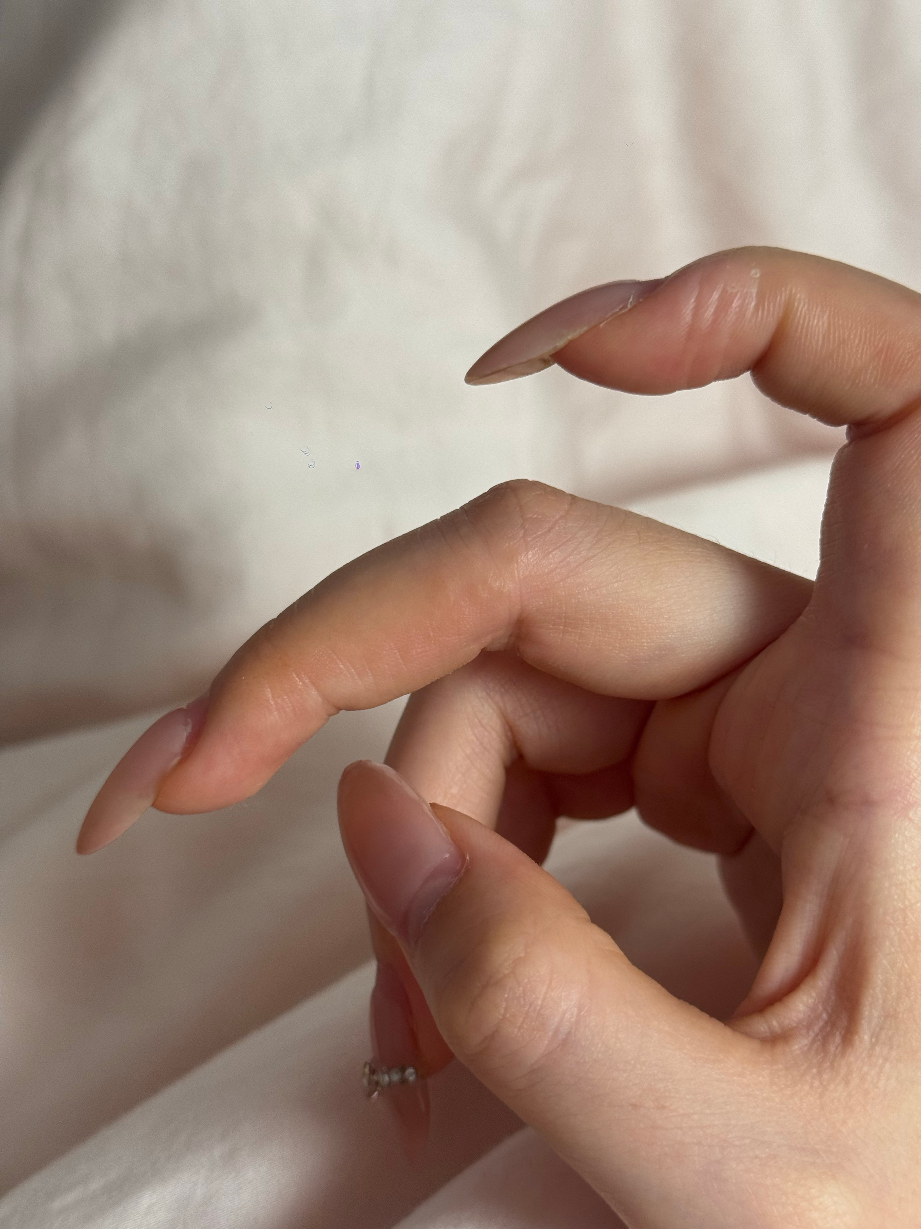 好崩溃 这疱疹有没有懂的 