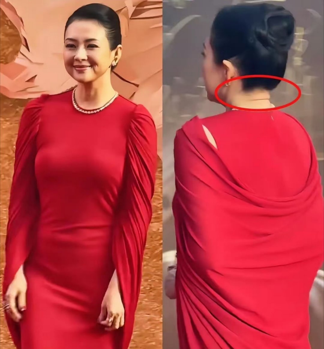 章子怡脸咋了 “国际章”章子怡在参加活动时，面部状态与以往差异明显，脖后赘肉较大