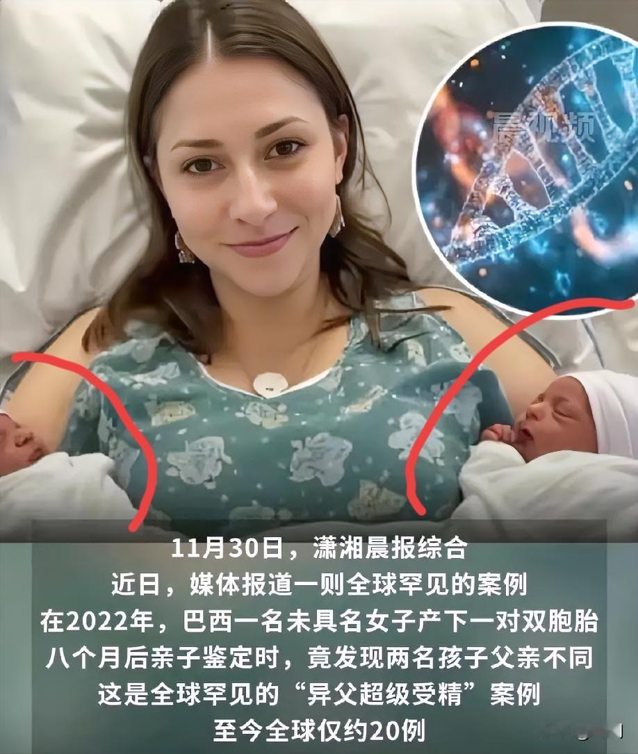 拼爹爹？拼单成功！
女子同一晚与不同男人发生关系怀孕！
事发巴西，据悉这名女子承