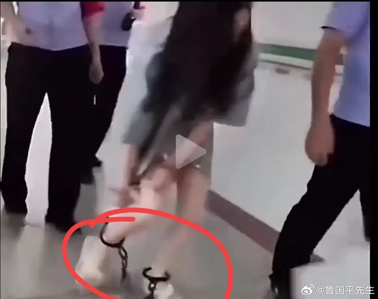 有网友在医院拍到一个戴脚镣的女犯人，可能因为脚镣太重磨破了皮肤，所以女子用手拉着