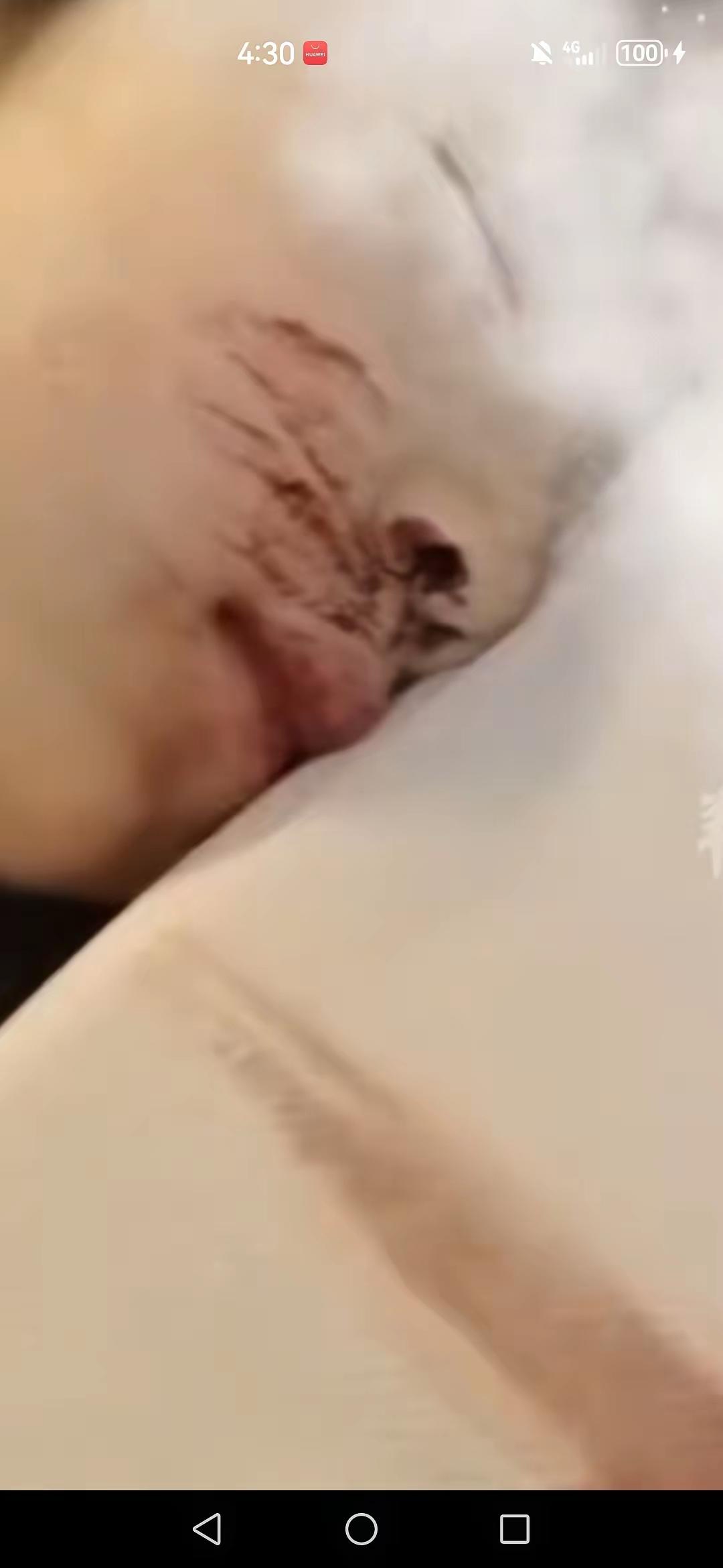 天塌了！女儿半夜发高烧睡着流鼻血，吓坏了爸妈，叫醒女儿后，连夜去医院挂急诊检查，