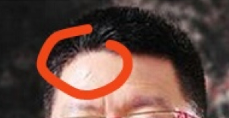 发际线里面有原生家庭带给每个人一辈子都难以再被改造的情绪。 