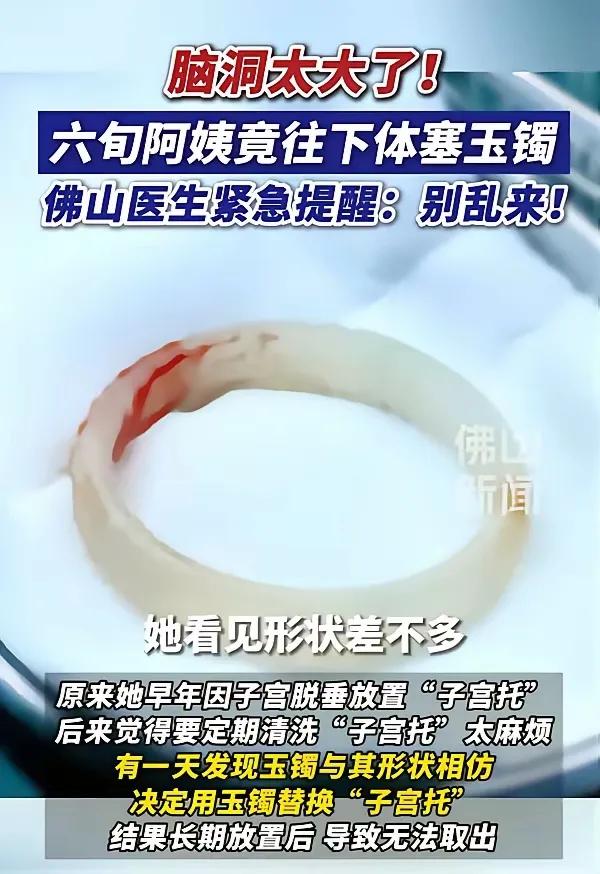 广州一65岁阿姨因为“阴道异物”去医院检查，结果医生发现里面竟有一只玉镯，几经追