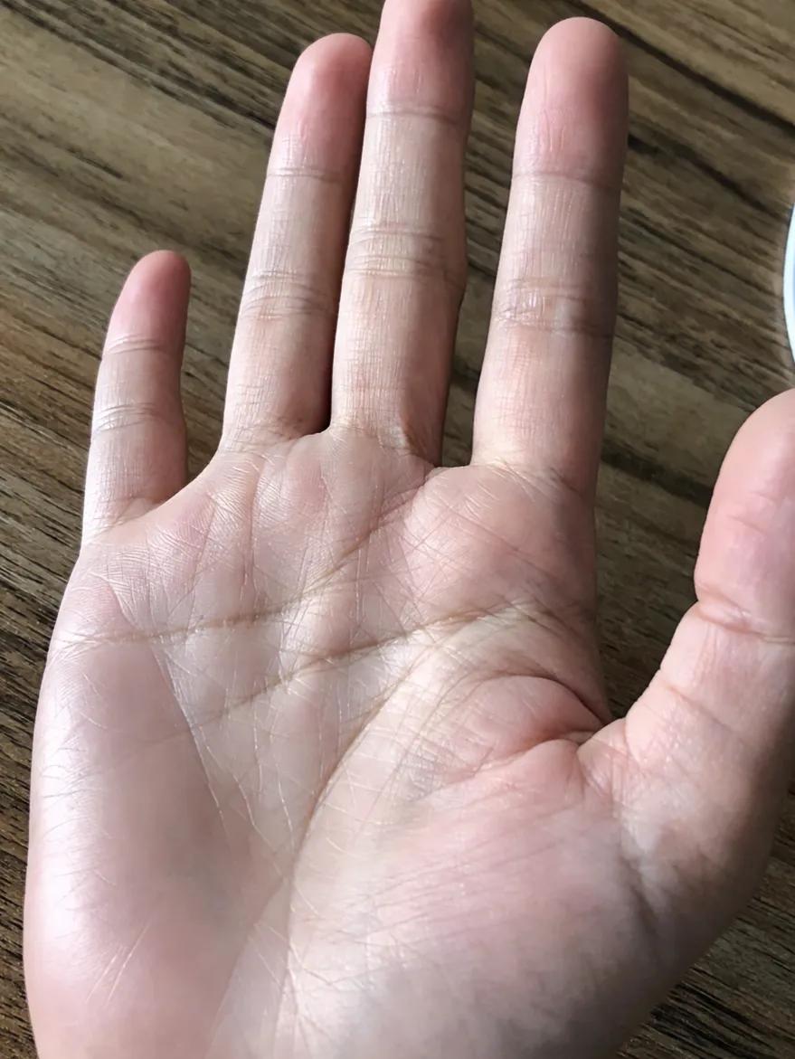 很焦虑的小手#焦虑的明天# #今年感觉挺累的# #再熬一夜吧# #生病的经历分享
