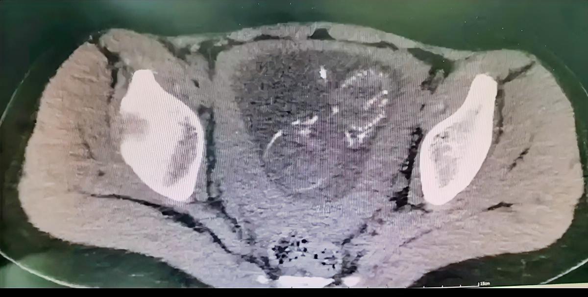 13岁女孩下腹痛，该不该问有无性生活史？一般小女孩都会有父母陪伴看病，医生问可能