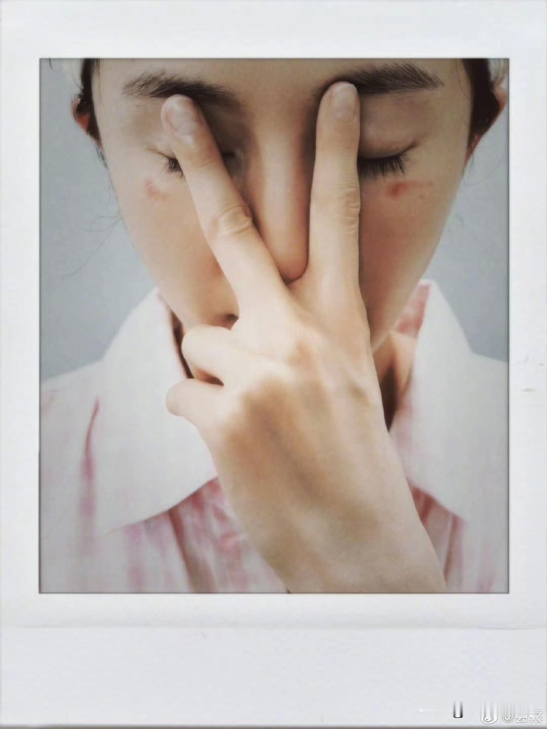 杨幂脸被蒸汽眼罩烫伤这事我是持保留态度的，理由很简单，一是蒸汽眼罩的温度都不高，