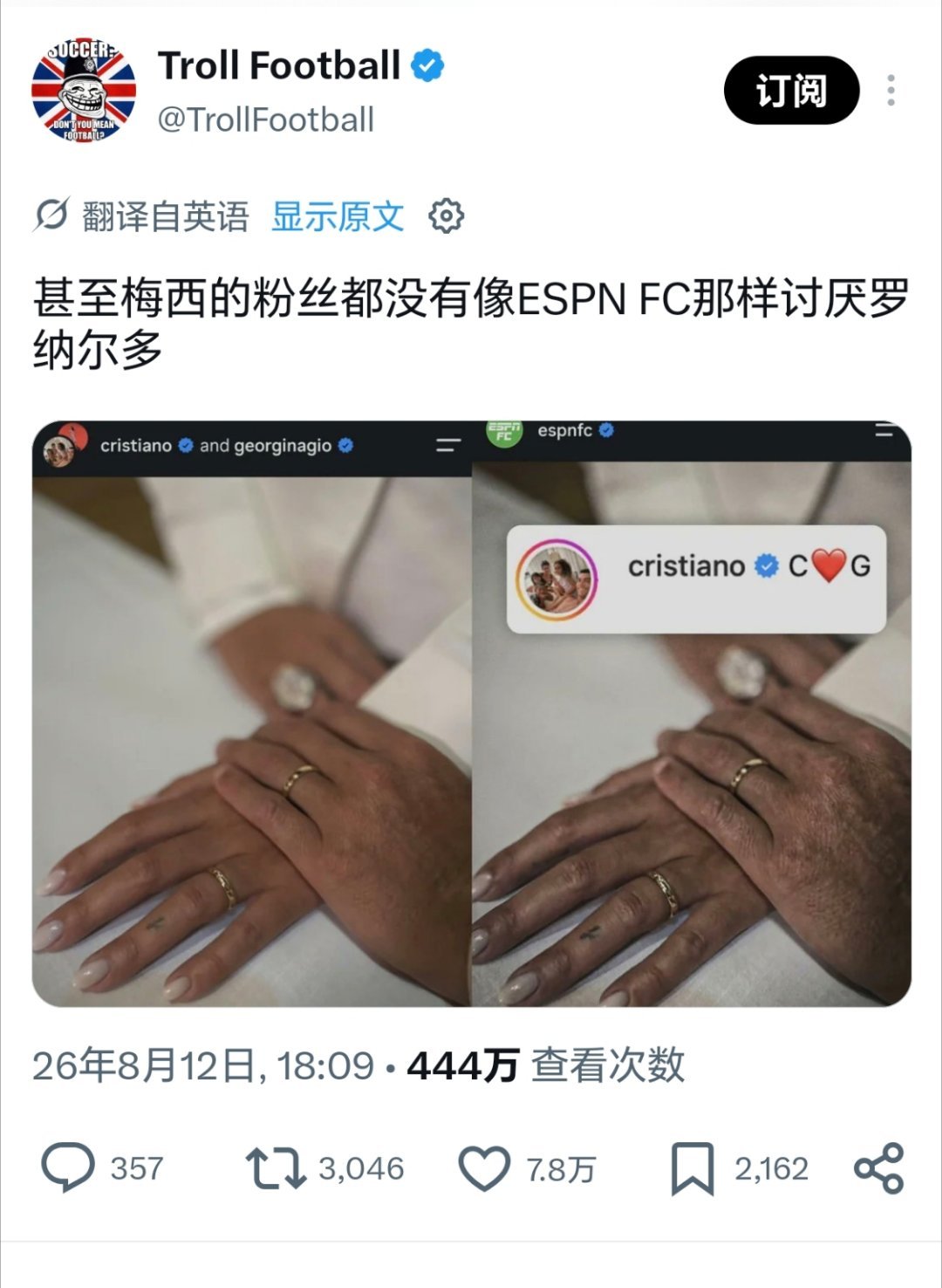 ESPN是有多讨厌C罗啊，P的都有60+了吧 