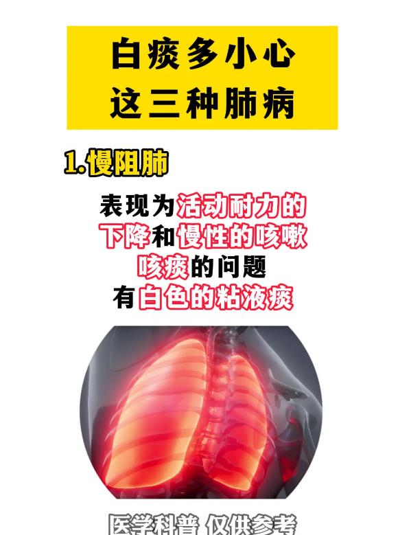 白痰增多别大意，这几种肺部状态要多留意