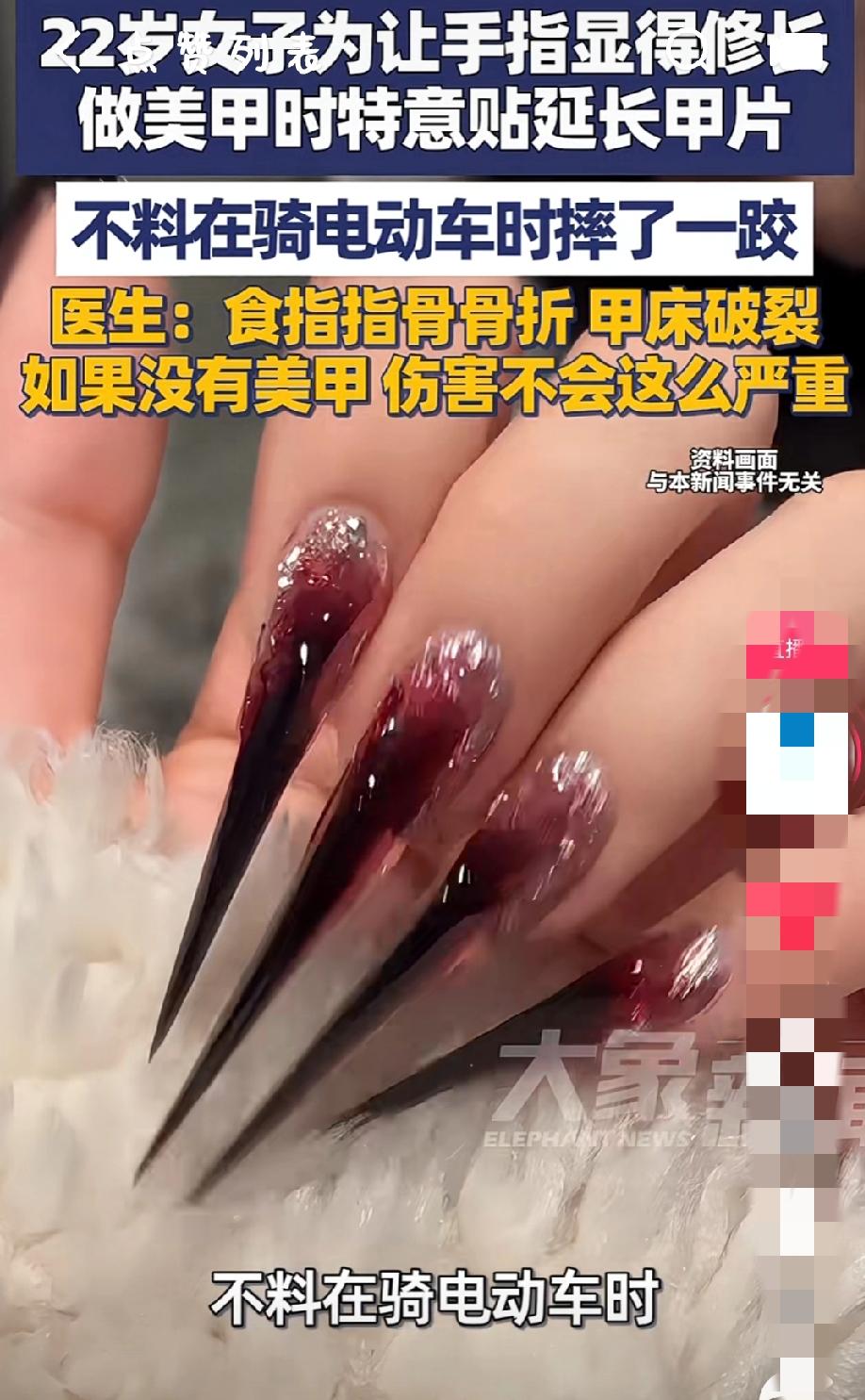 美是真美，但疼也是真疼！22岁女生为显手长做延长甲，骑车一摔直接骨折甲床破裂！