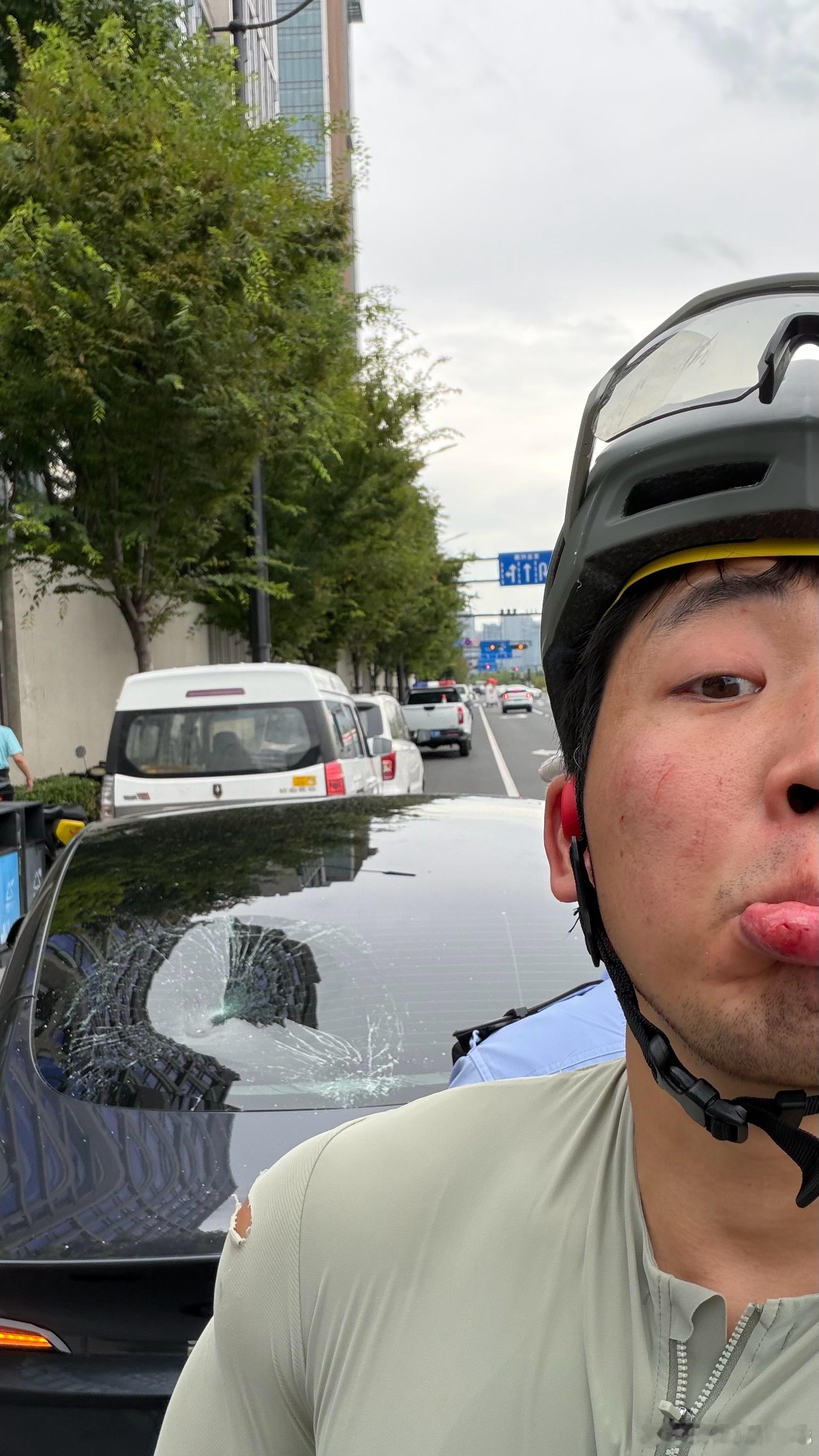 头盔救了半条命  ​​​