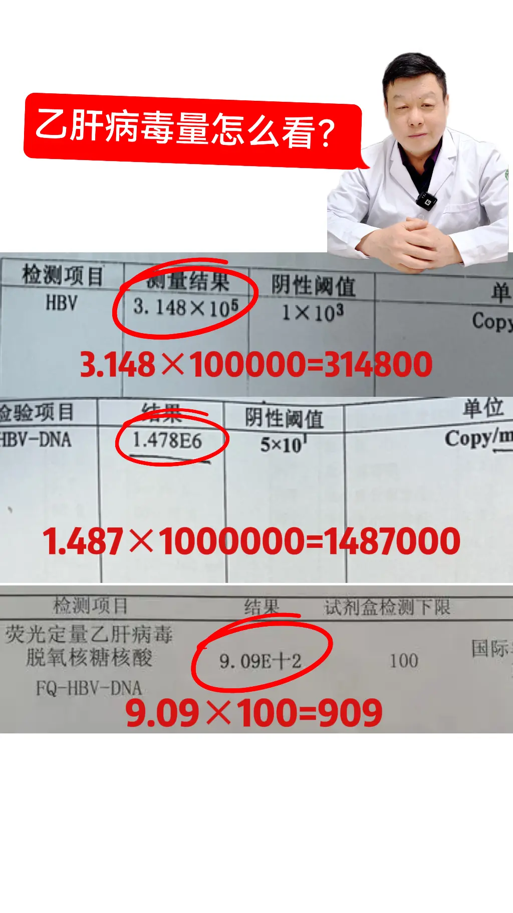 涨知识 乙肝病毒量 山东 肝病医生杨军