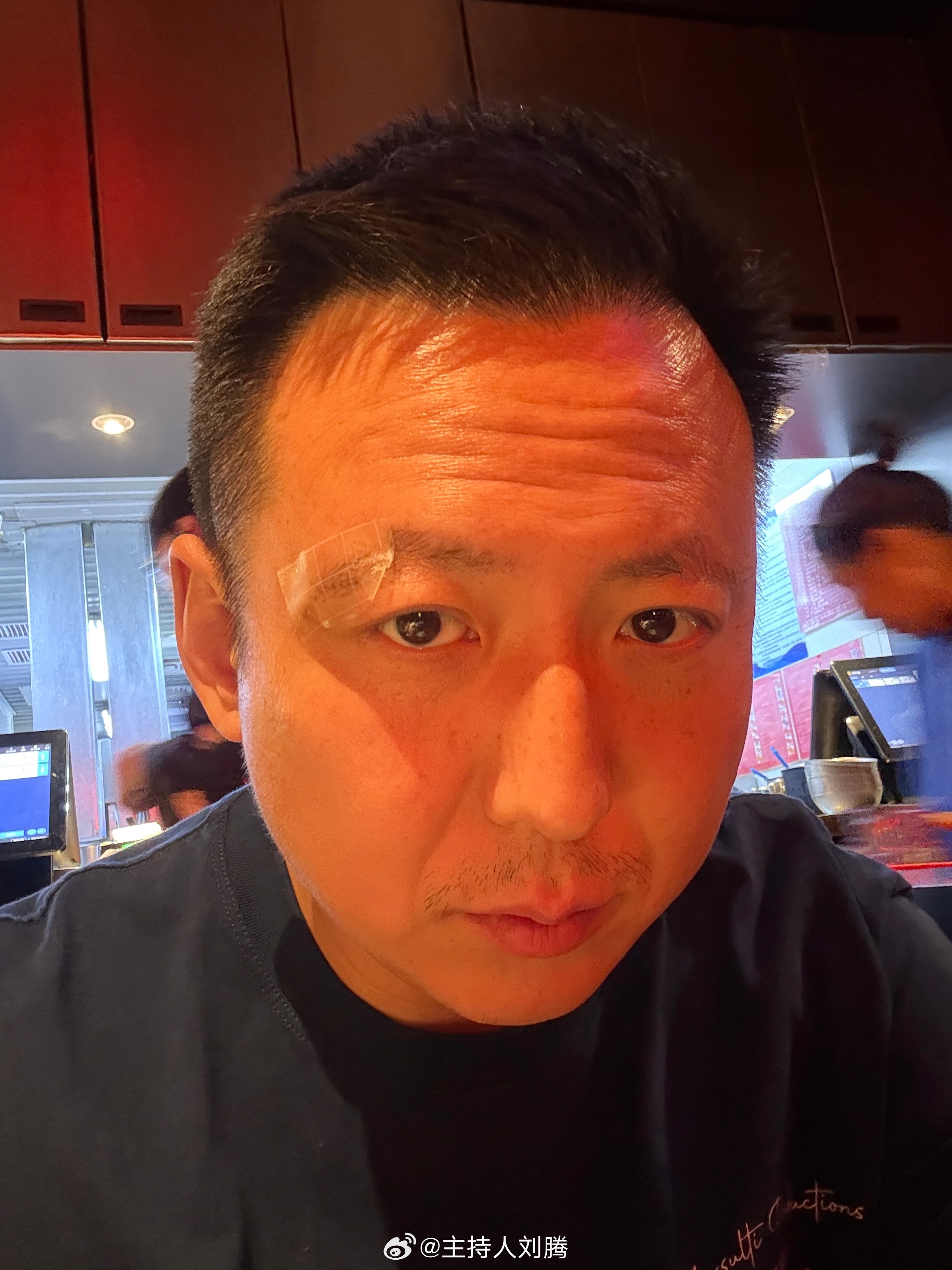 球踢不咋地，伤的挺专业 