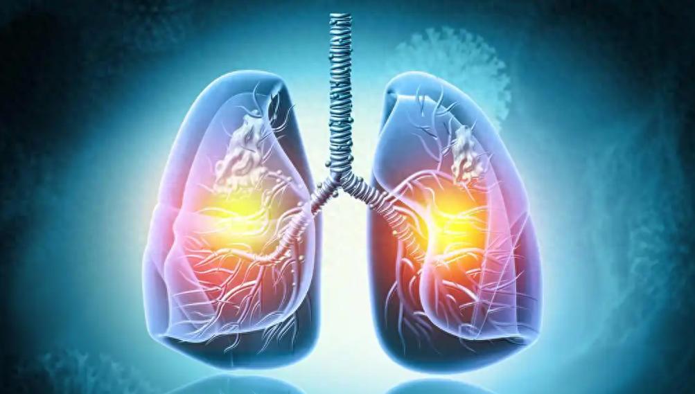 想要身体强，补肺少不了！4 个经典方，给肺脏加个 “金钟罩”
作品声明：个人观点